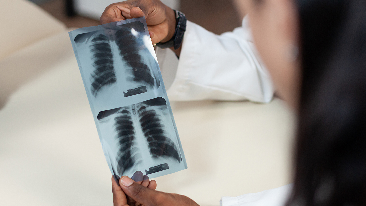 doctor holding a chest x-ray and showing to a patient.